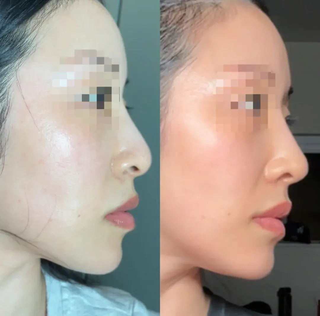RISE Plastic Surgery — 3