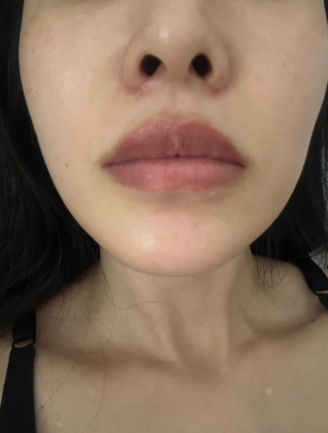 RISE Plastic Surgery — 4