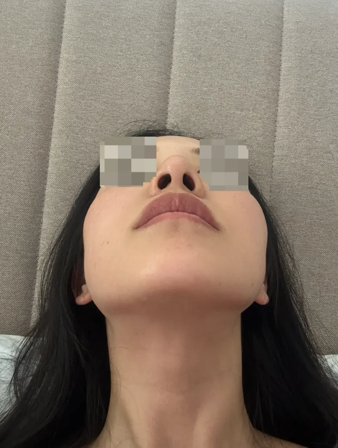 RISE Plastic Surgery — 5