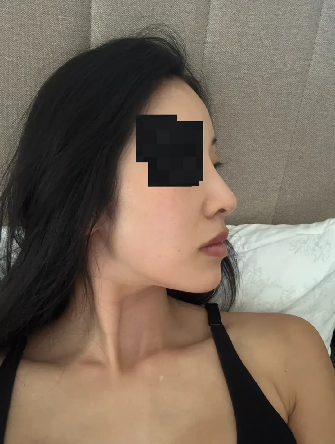 RISE Plastic Surgery — 6