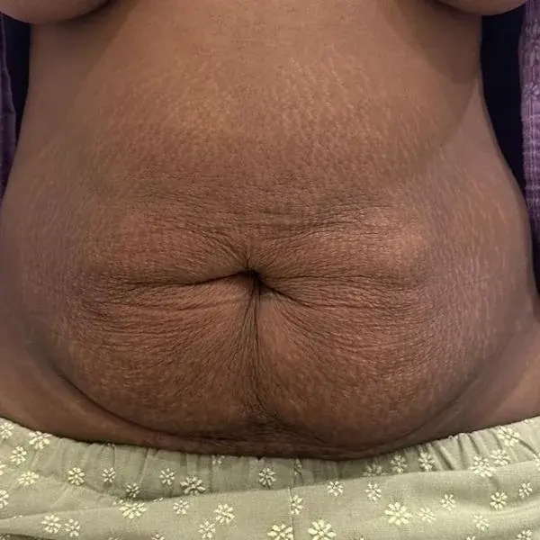 I'M Plastic Surgery — 1