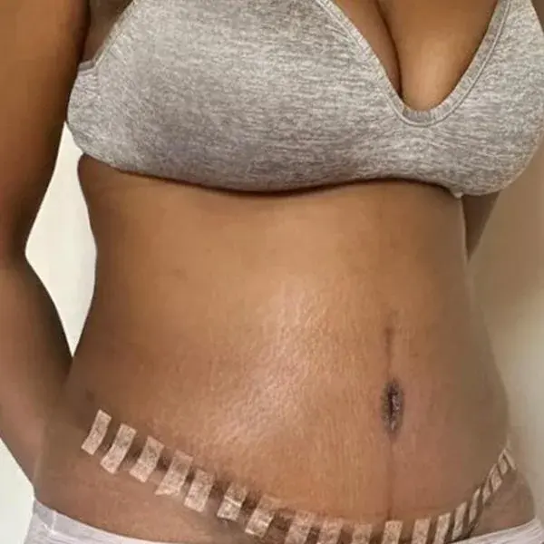 I'M Plastic Surgery — 2