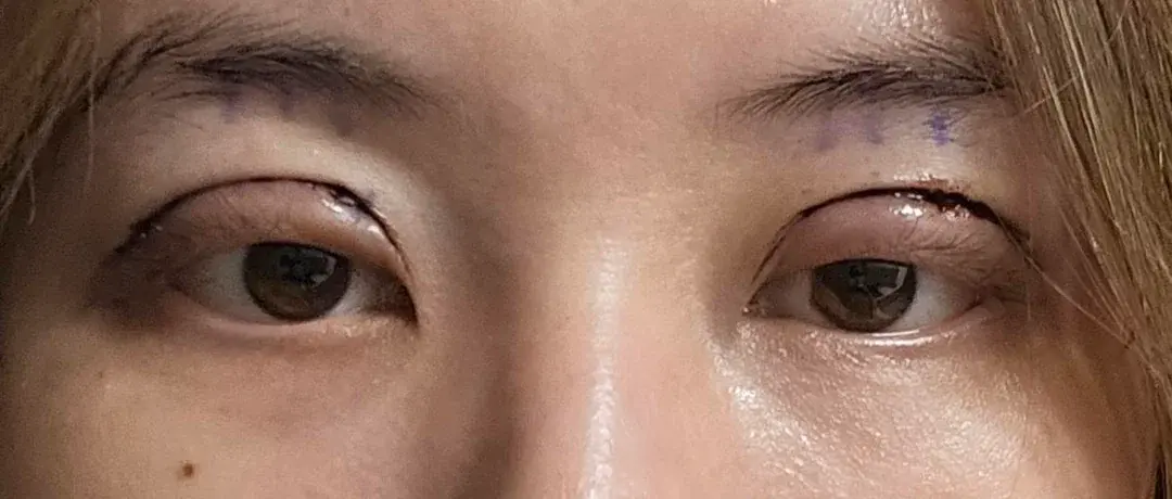 TOP TIER Plastic Surgery — 2