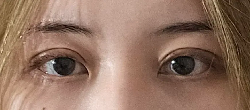 TOP TIER Plastic Surgery — 3
