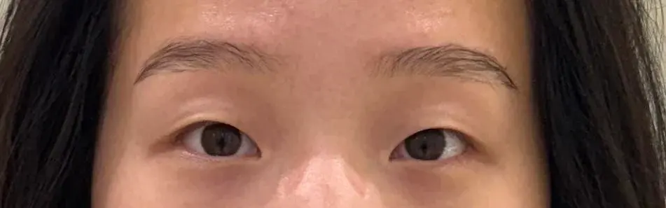 BYWON Plastic Surgery — 1