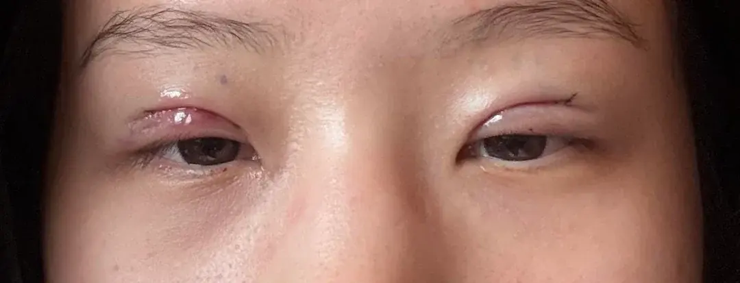 BYWON Plastic Surgery — 2