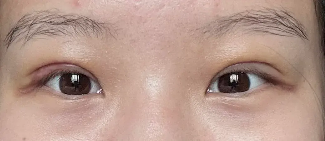 BYWON Plastic Surgery — 3