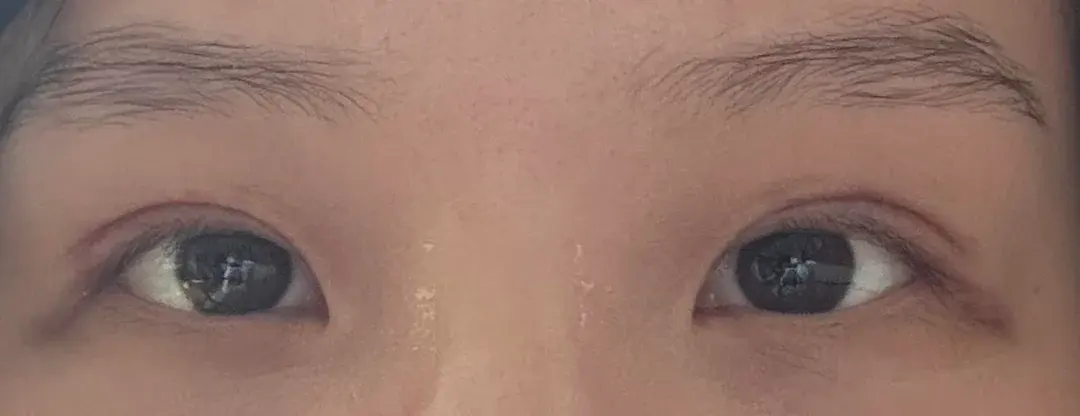 BYWON Plastic Surgery — 4