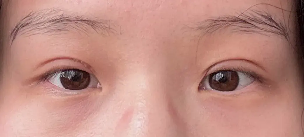BYWON Plastic Surgery — 5