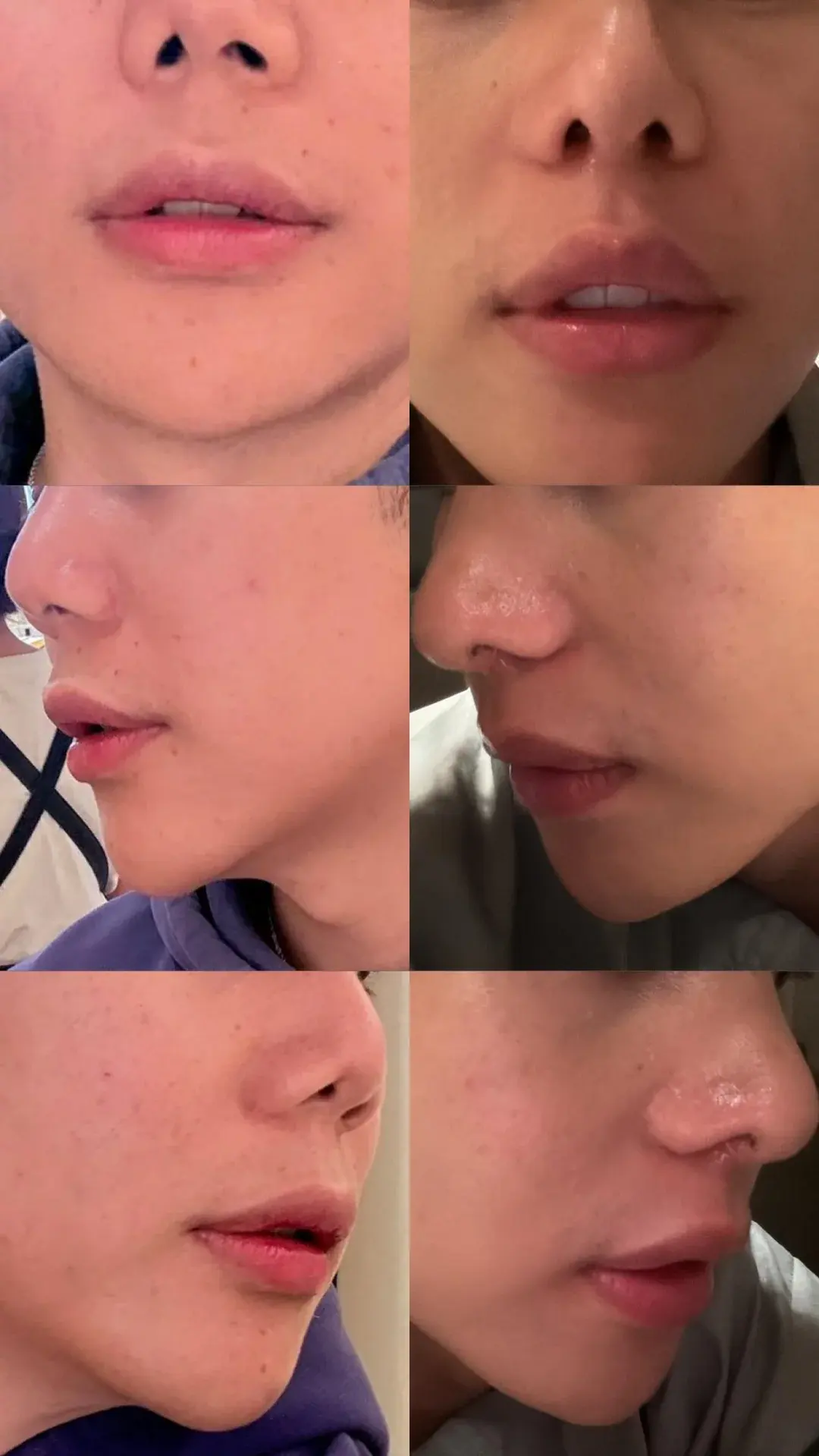 Retmus Plastic Surgery — 1