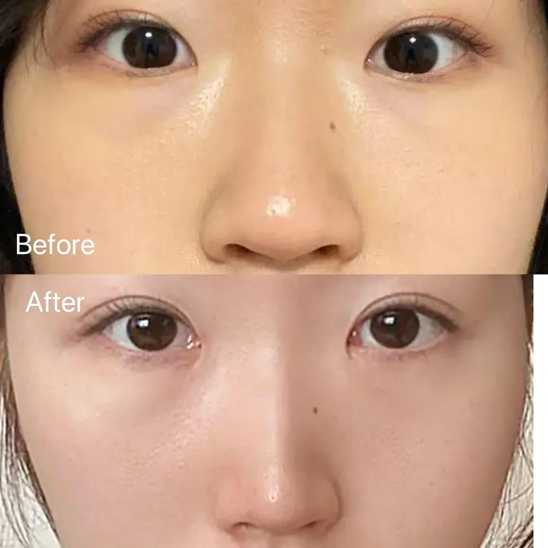 BBAE Clinic — 1