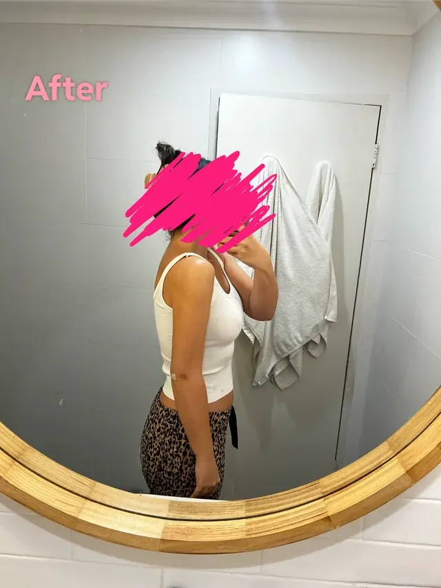 Garnet Plastic Surgery — 5