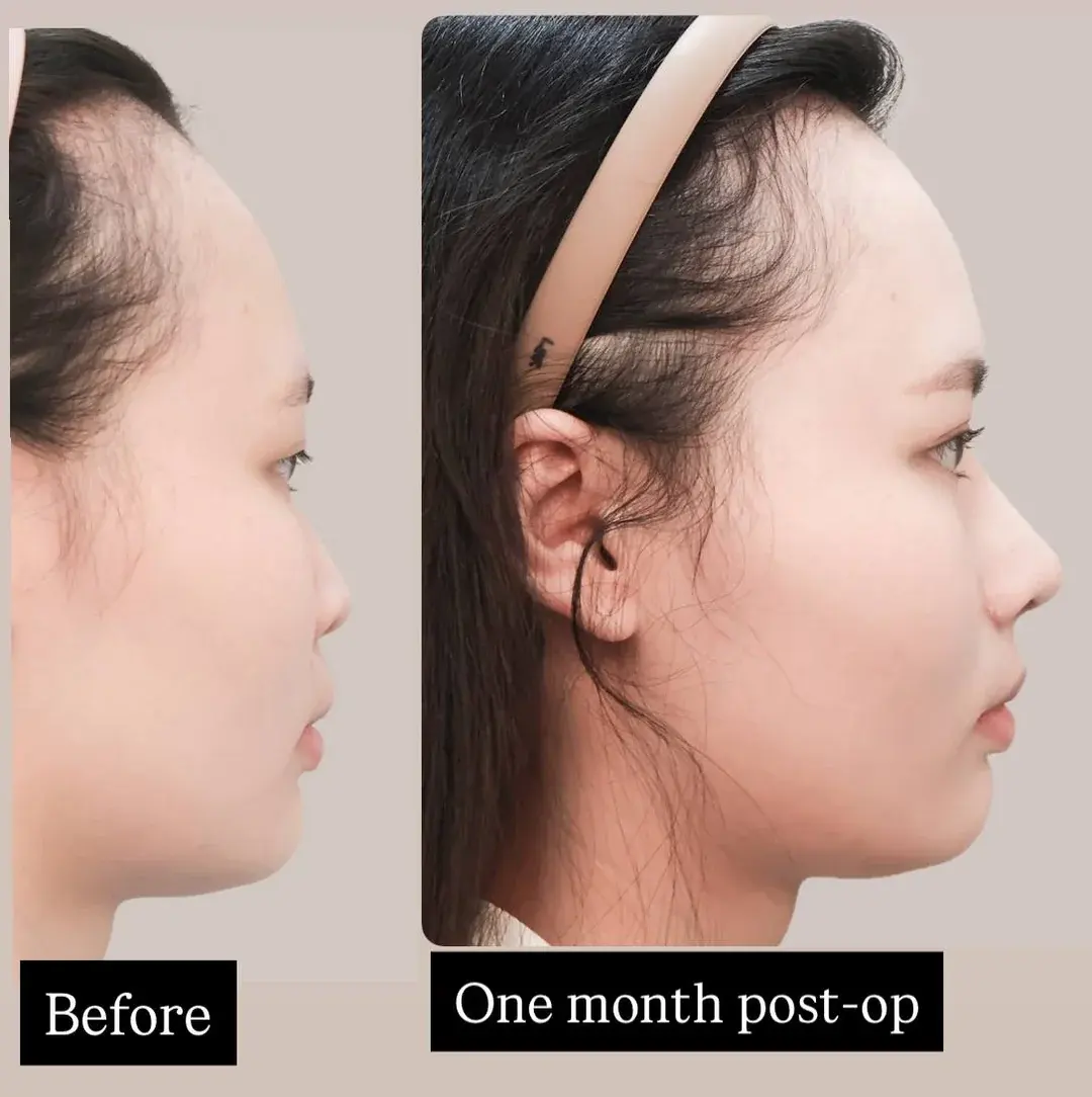 VIBE Plastic Surgery — 3