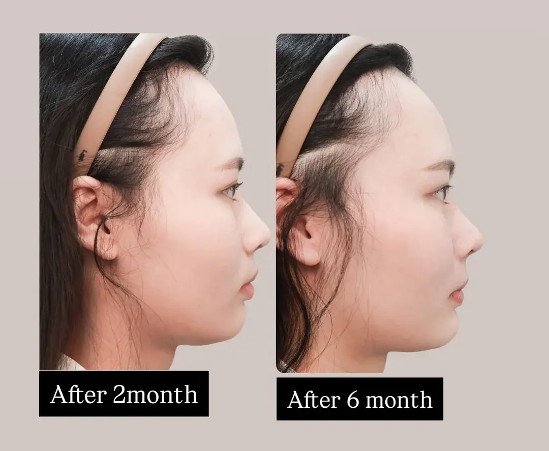 VIBE Plastic Surgery — 4