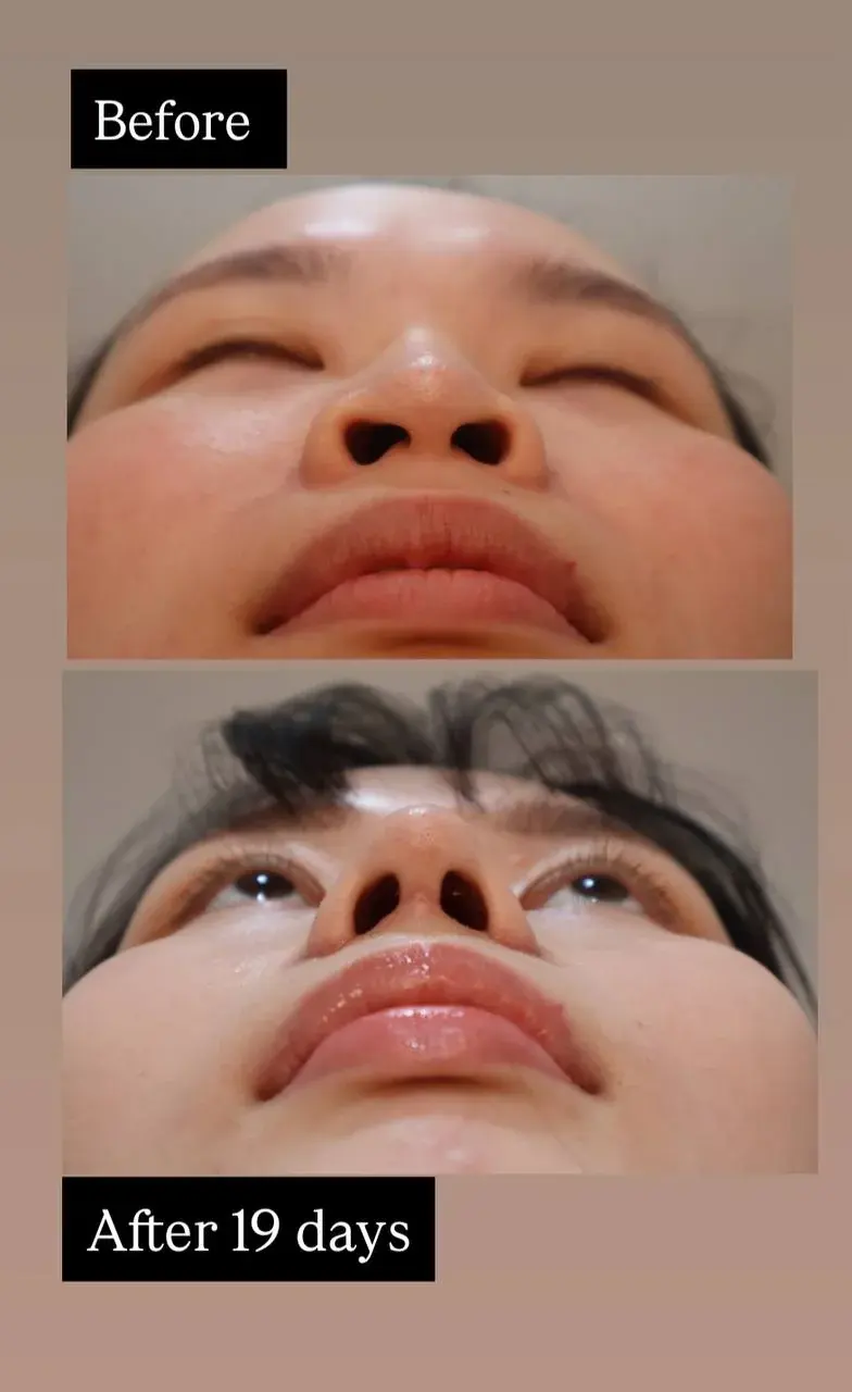 VIBE Plastic Surgery — 5