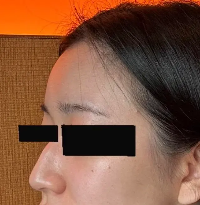 BT Plastic Surgery — 1