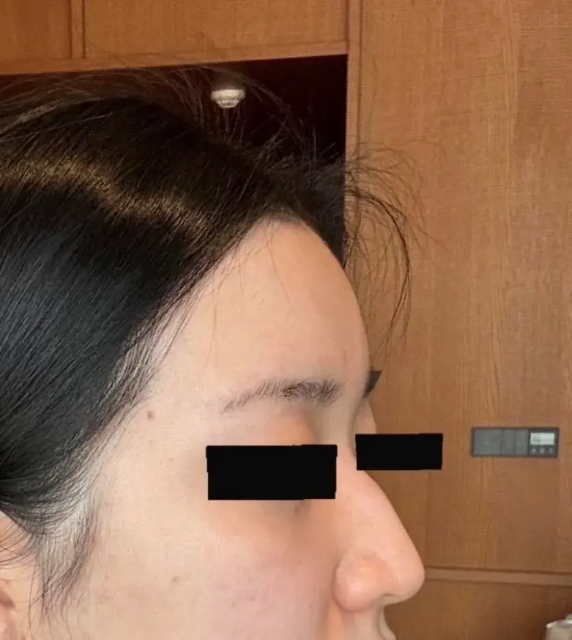 BT Plastic Surgery — 2