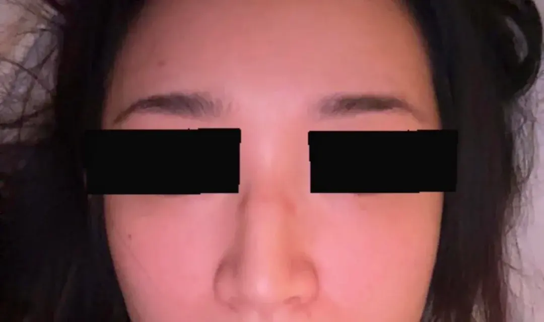BT Plastic Surgery — 3