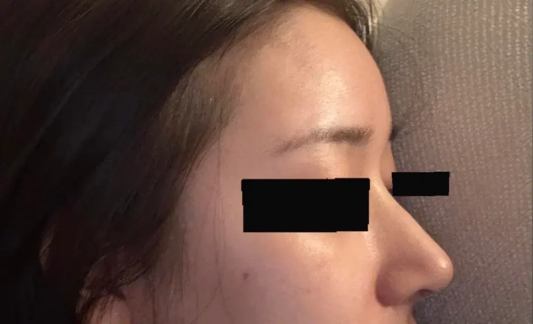 BT Plastic Surgery — 4