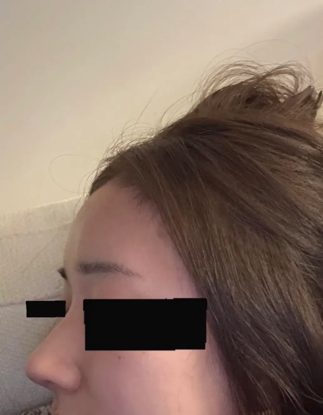 BT Plastic Surgery — 5