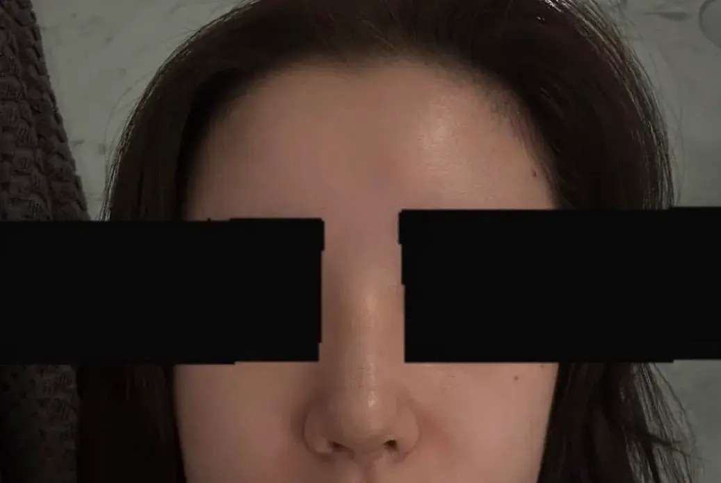 BT Plastic Surgery — 7