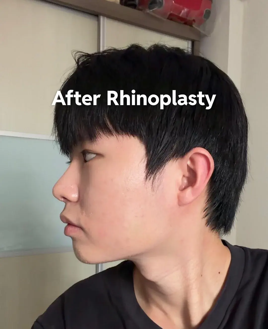 Eight Plastic Surgery Clinic — 6