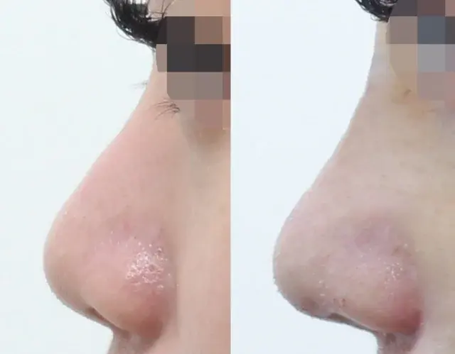 BYUL Plastic Surgery — 1
