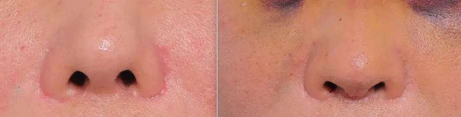 JW Plastic Surgery — 1