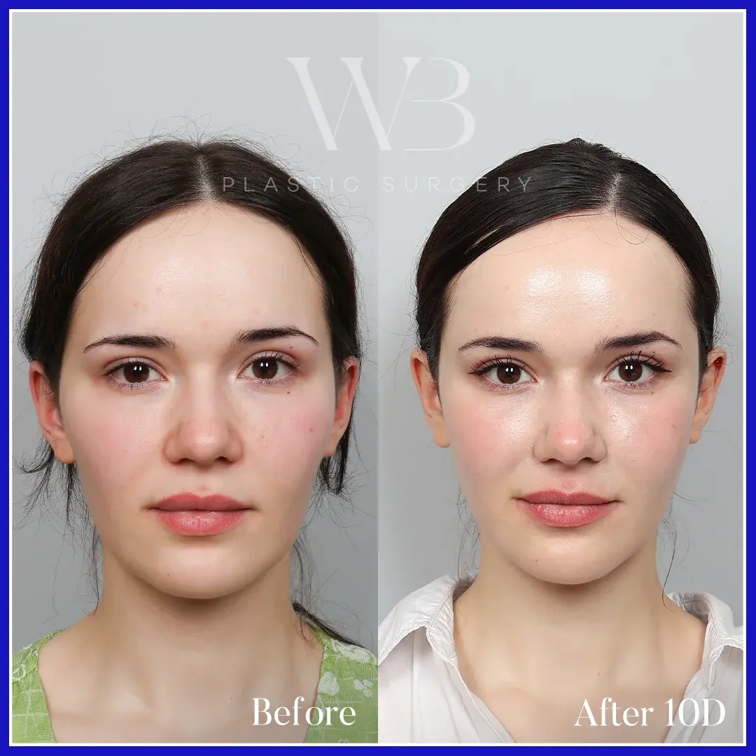 MOOi Plastic Surgery — 1