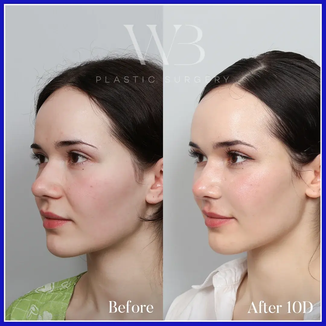 MOOi Plastic Surgery — 2