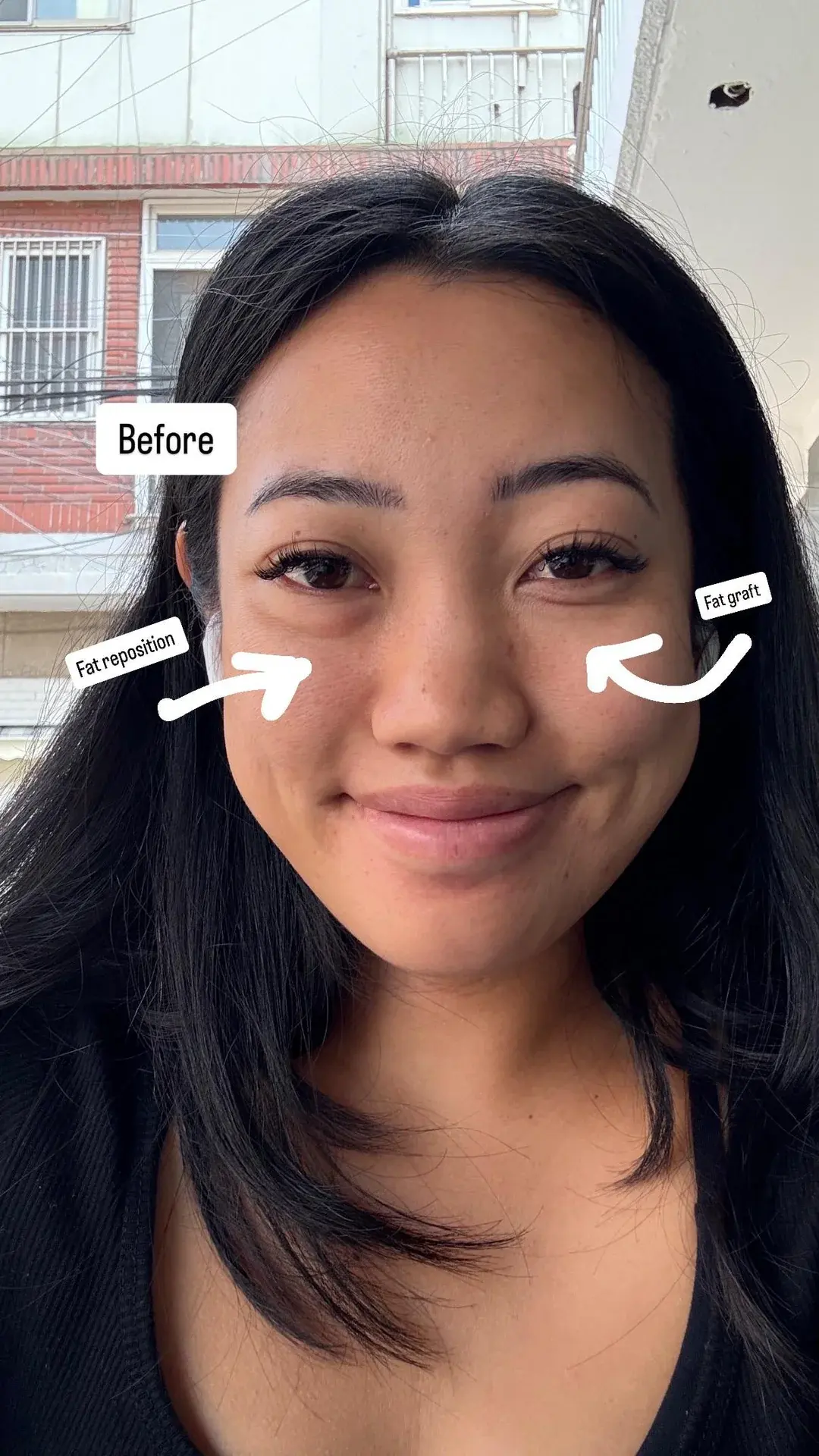 AB Plastic Surgery — 1