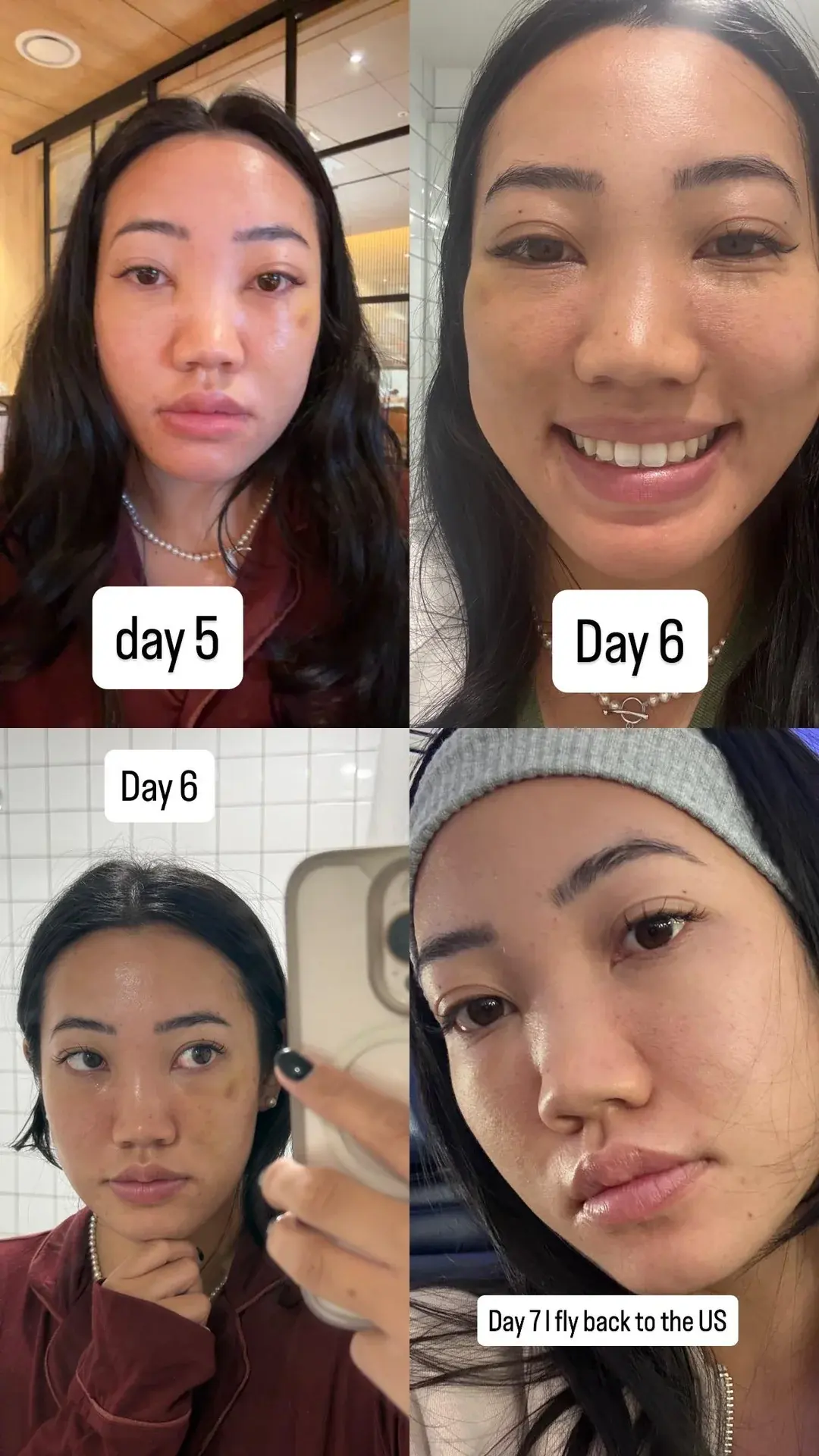 AB Plastic Surgery — 5