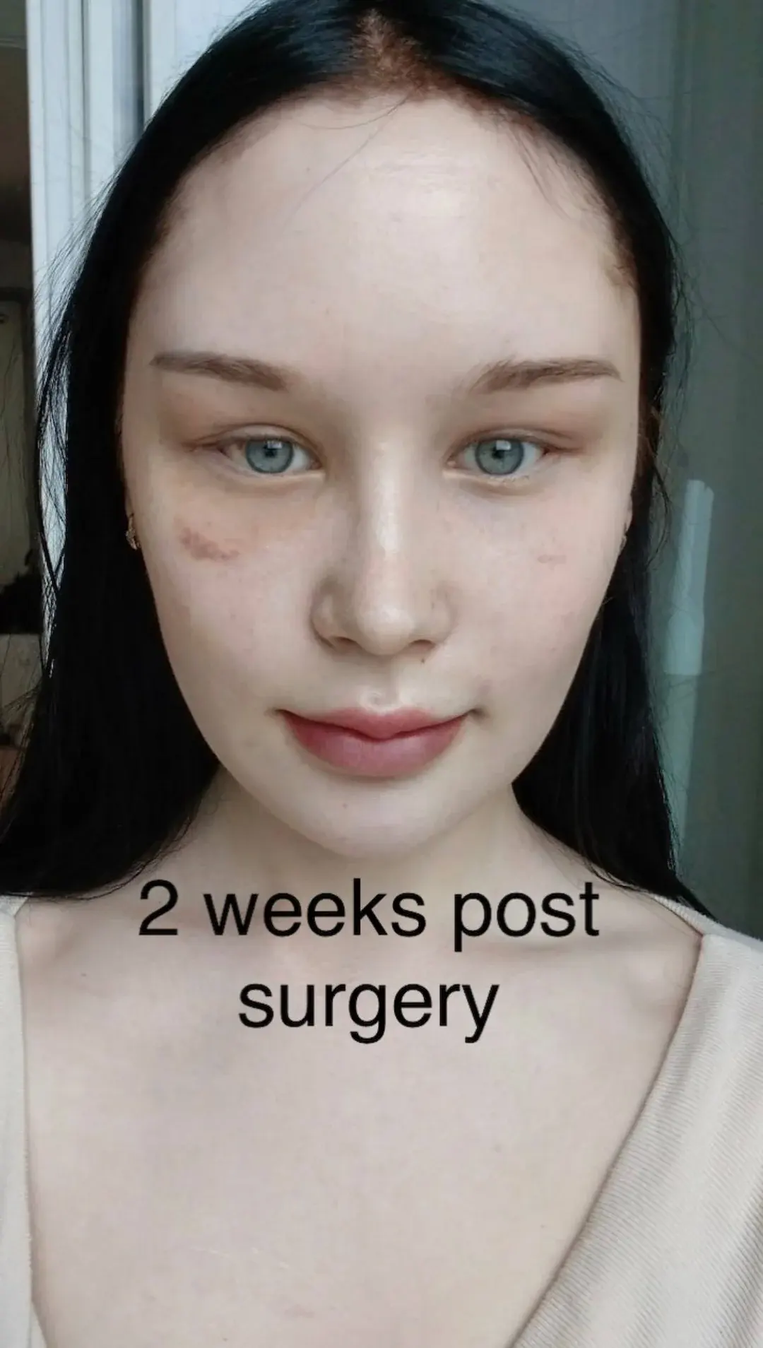WOOA Plastic Surgery — 2