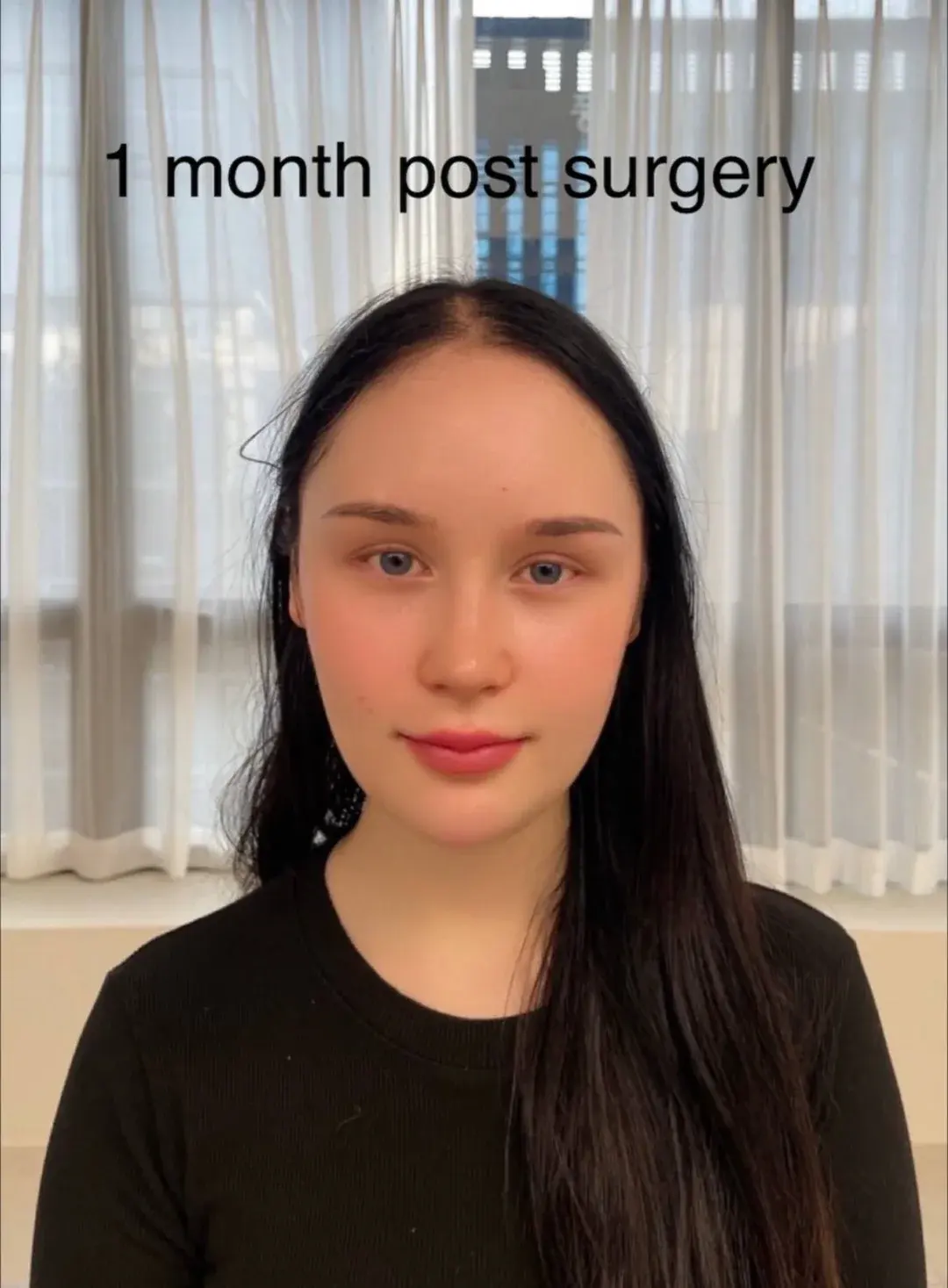 WOOA Plastic Surgery — 3