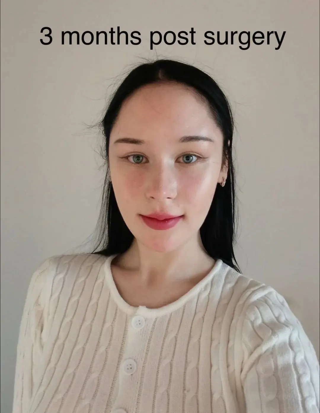 WOOA Plastic Surgery — 4