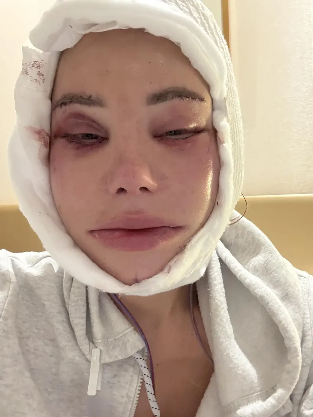 AB Plastic Surgery — 1