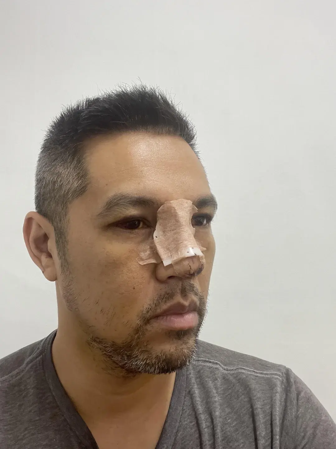 GU Plastic Surgery — 1