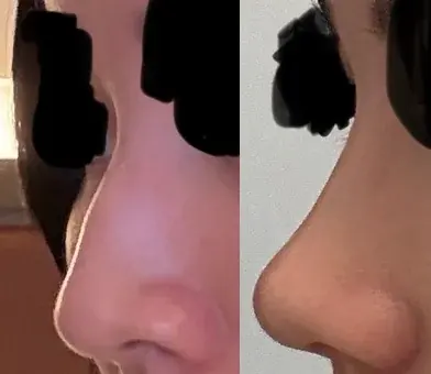 BRAUN Plastic Surgery — 2