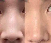 BRAUN Plastic Surgery — 3