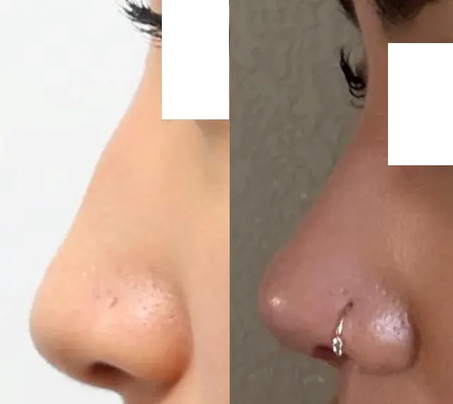 BT Plastic Surgery — 1