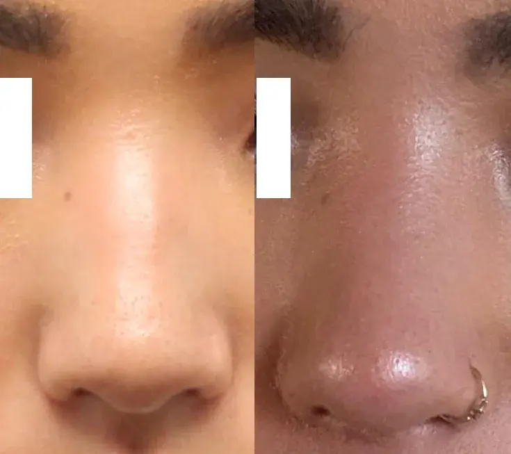BT Plastic Surgery — 2