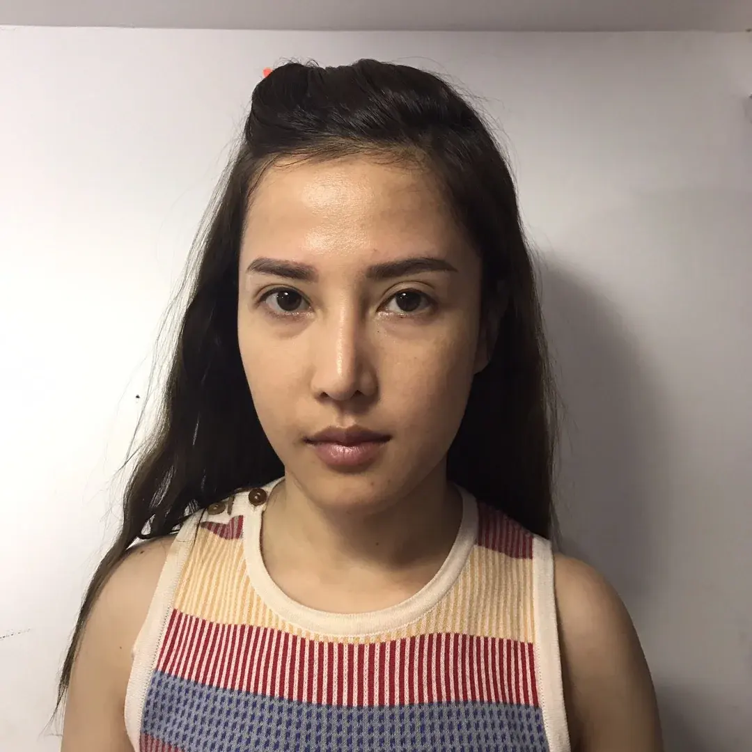Midline Plastic Surgery — 1
