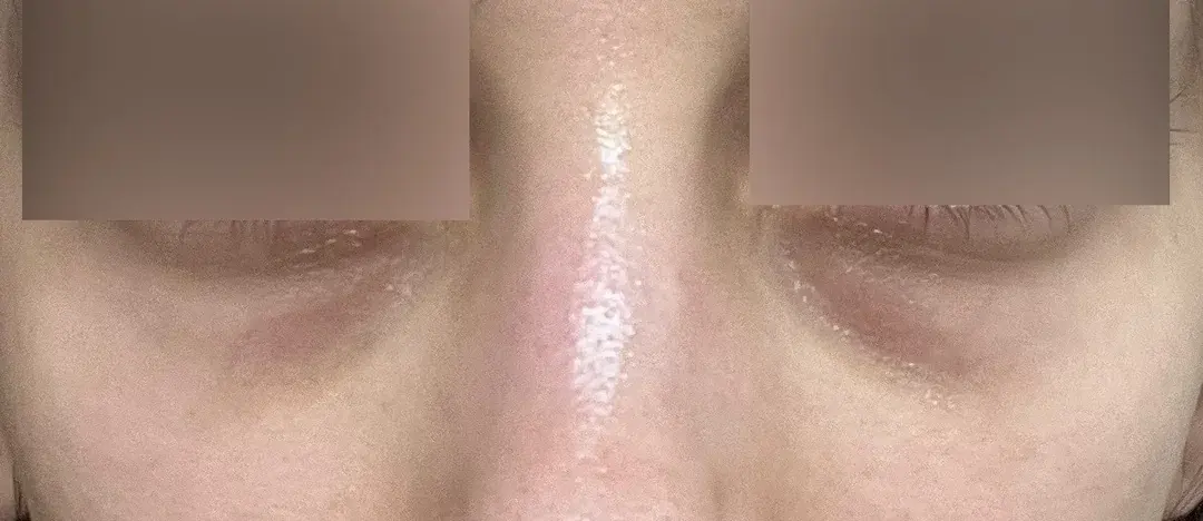 NANA Plastic Surgery — 1