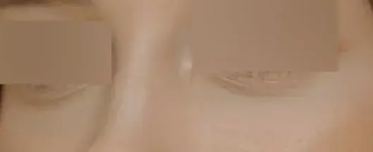 NANA Plastic Surgery — 2