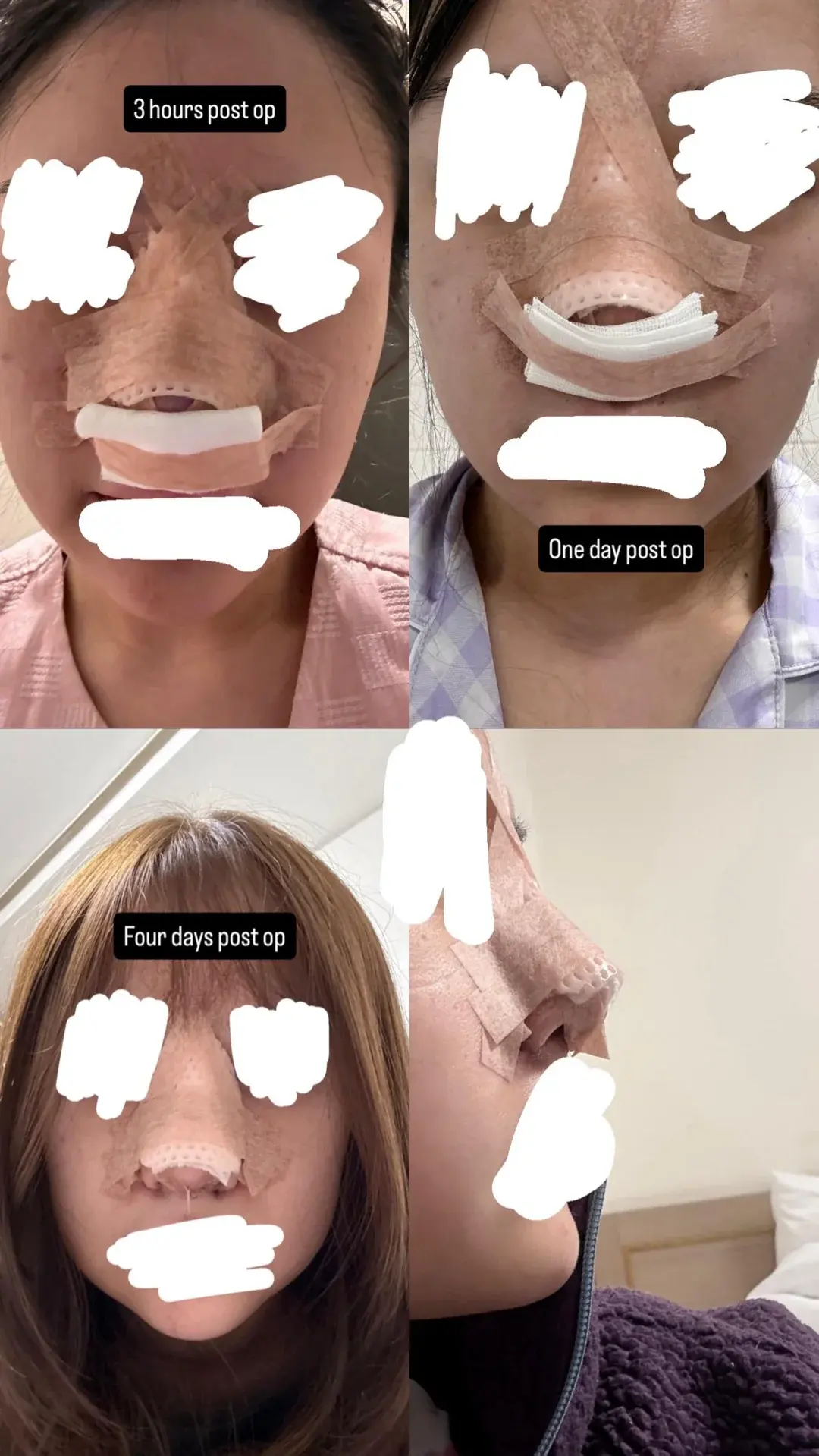 KOWON Plastic Surgery — 2