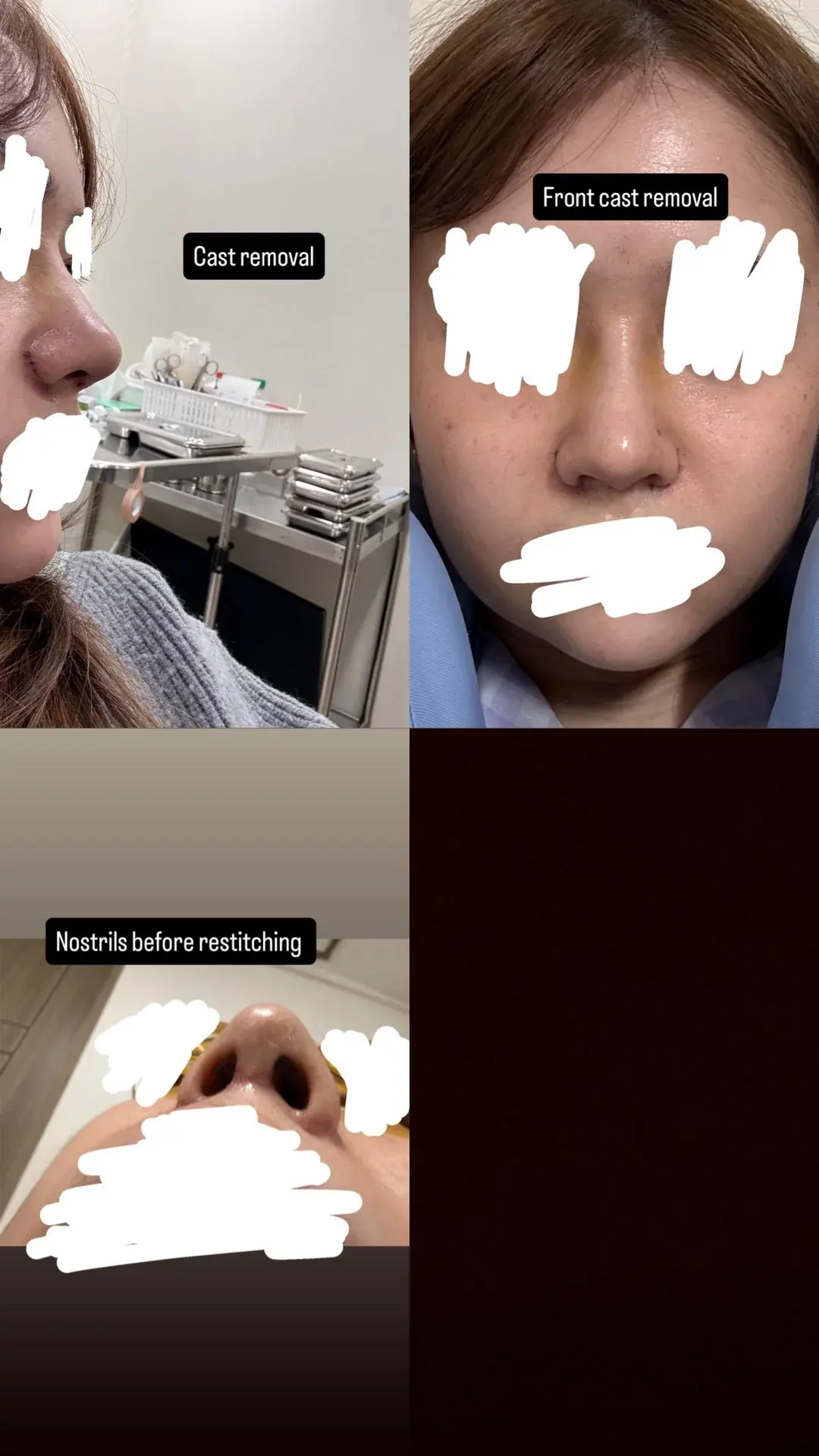 KOWON Plastic Surgery — 3