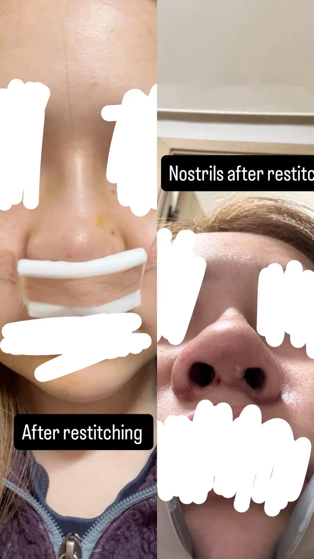 KOWON Plastic Surgery — 4