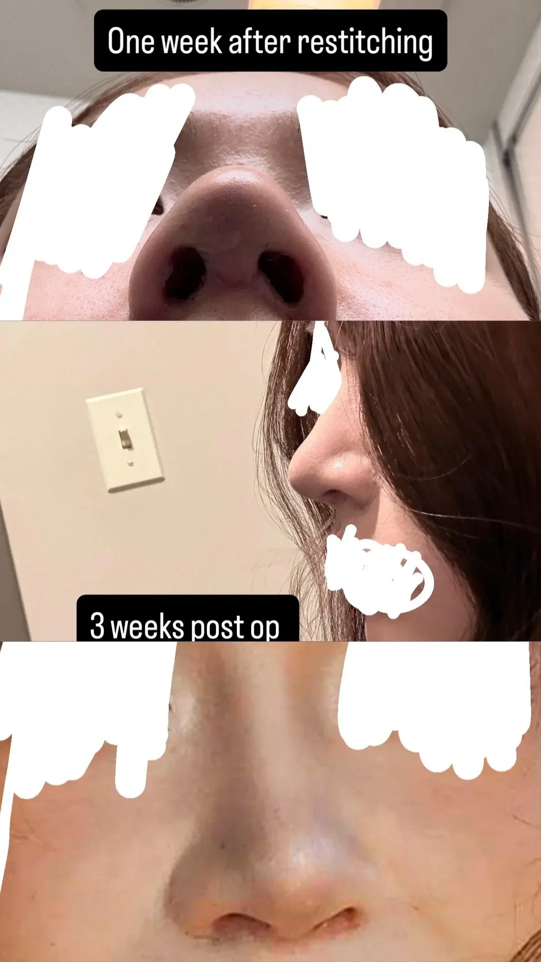 KOWON Plastic Surgery — 5