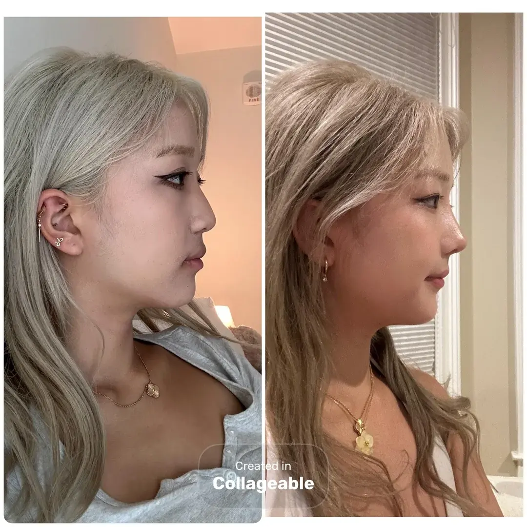 AB Plastic Surgery — 2
