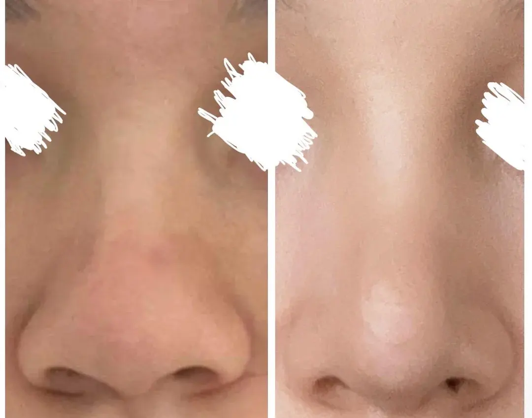 BT Plastic Surgery — 1